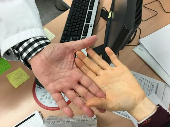 Motivos de consulta en hematología palidez